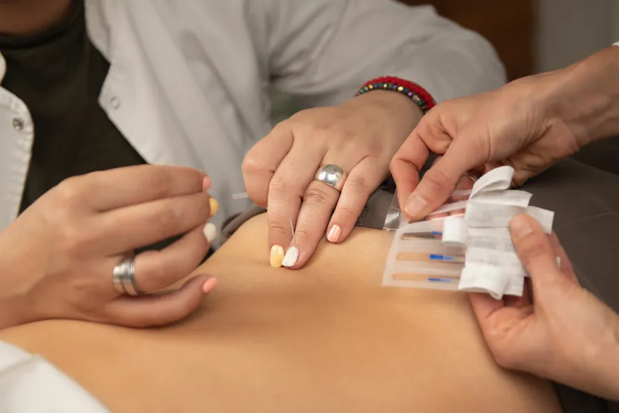 acupuncture treatment for low back pain in Worthing