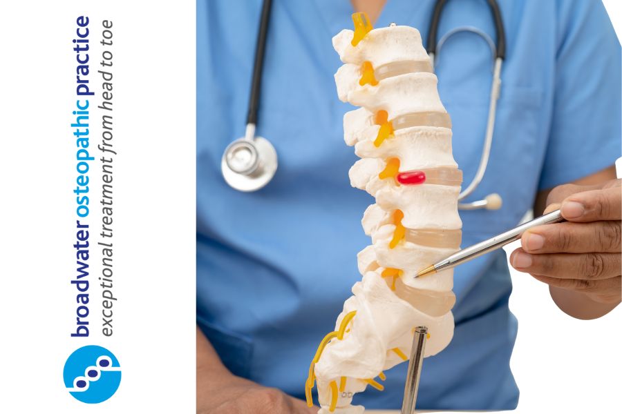 Sciatica Treatment Worthing